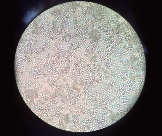 Legionella Bacteria Testing